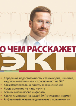 О чем расскажет ЭКГ