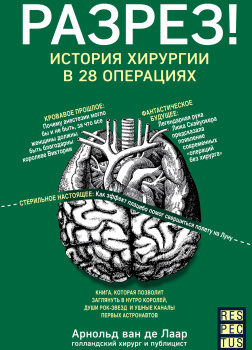 Разрез! История хирургии в 28 операциях